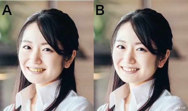 黄ばんだ歯の女性と白い歯の女性の比較